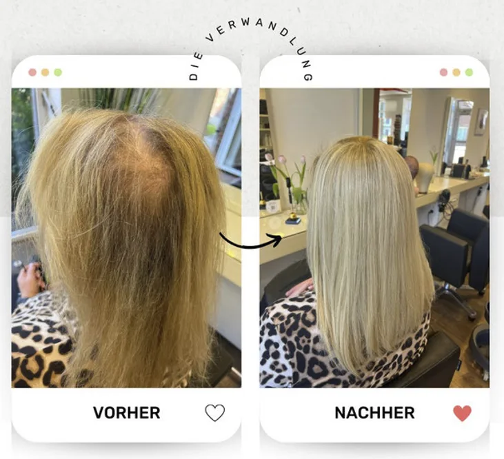 Vergleich vorher und nachher: Ergebnis einer Haarverdichtung bei BRÜHL Haarsysteme
